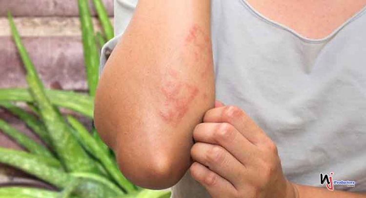 Las enfermedades de la piel más comunes en el país; cómo prevenirlas y tratarlas
