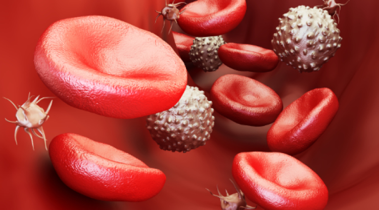 Púrpura trombocitopénica idiopática, la enfermedad “que se come las plaquetas”